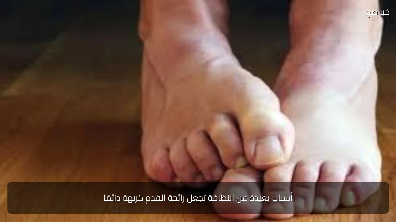 أسباب بعيدة عن النظافة تجعل رائحة القدم كريهة دائمًا