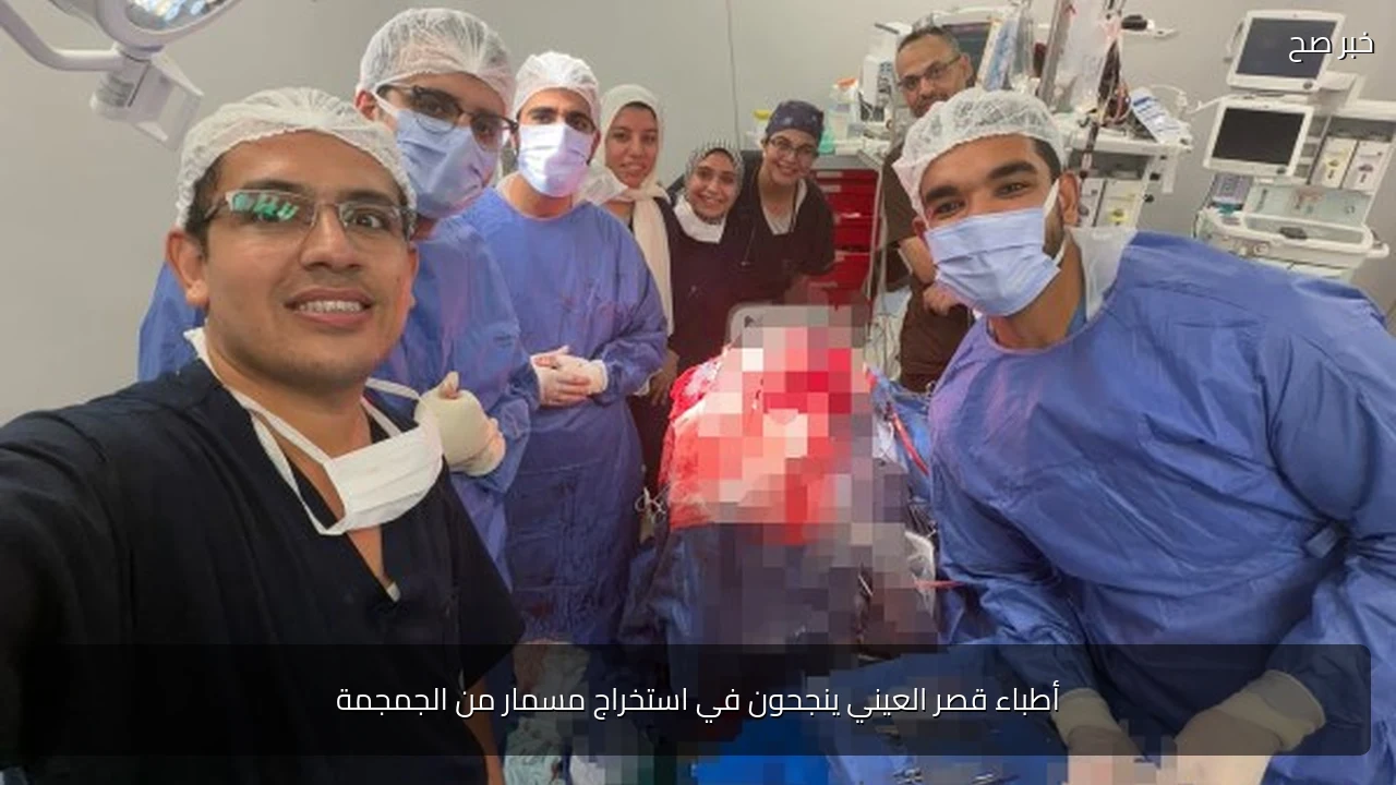أطباء قصر العيني ينجحون في استخراج مسمار من الجمجمة