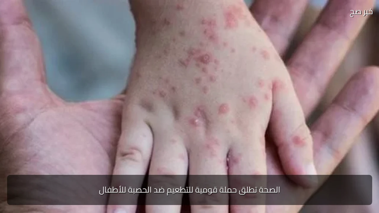 الصحة تطلق حملة قومية للتطعيم ضد الحصبة للأطفال