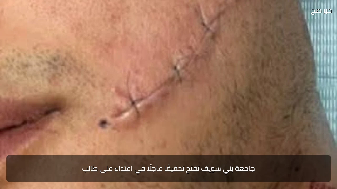 جامعة بني سويف تفتح تحقيقًا عاجلًا في اعتداء على طالب