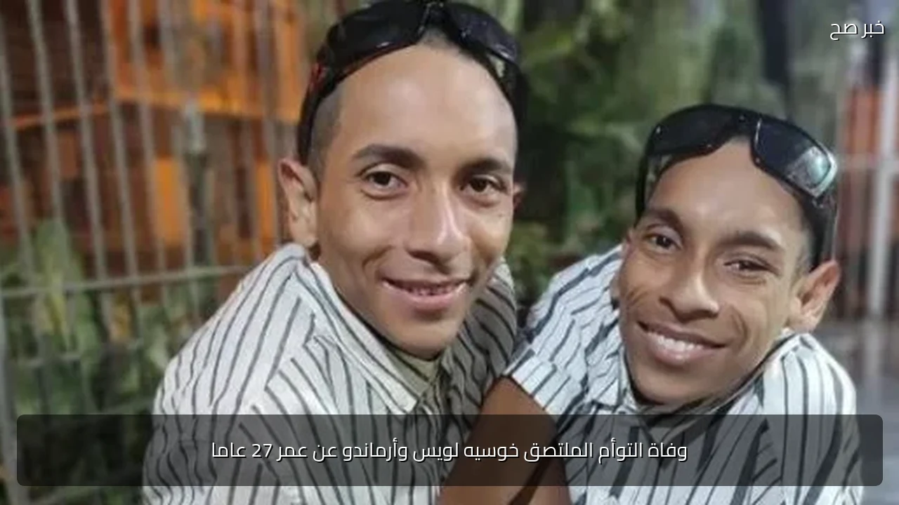 وفاة التوأم الملتصق خوسيه لويس وأرماندو عن عمر 27 عاما