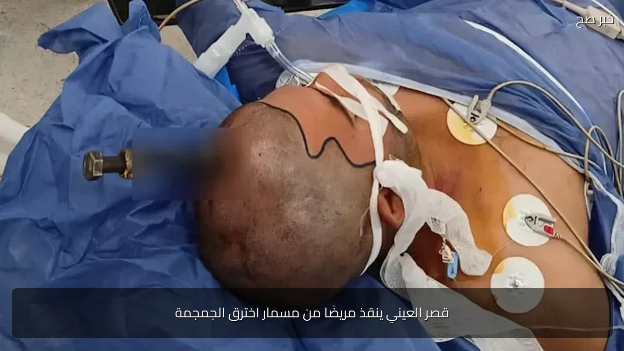 قصر العيني ينقذ مريضًا من مسمار اخترق الجمجمة