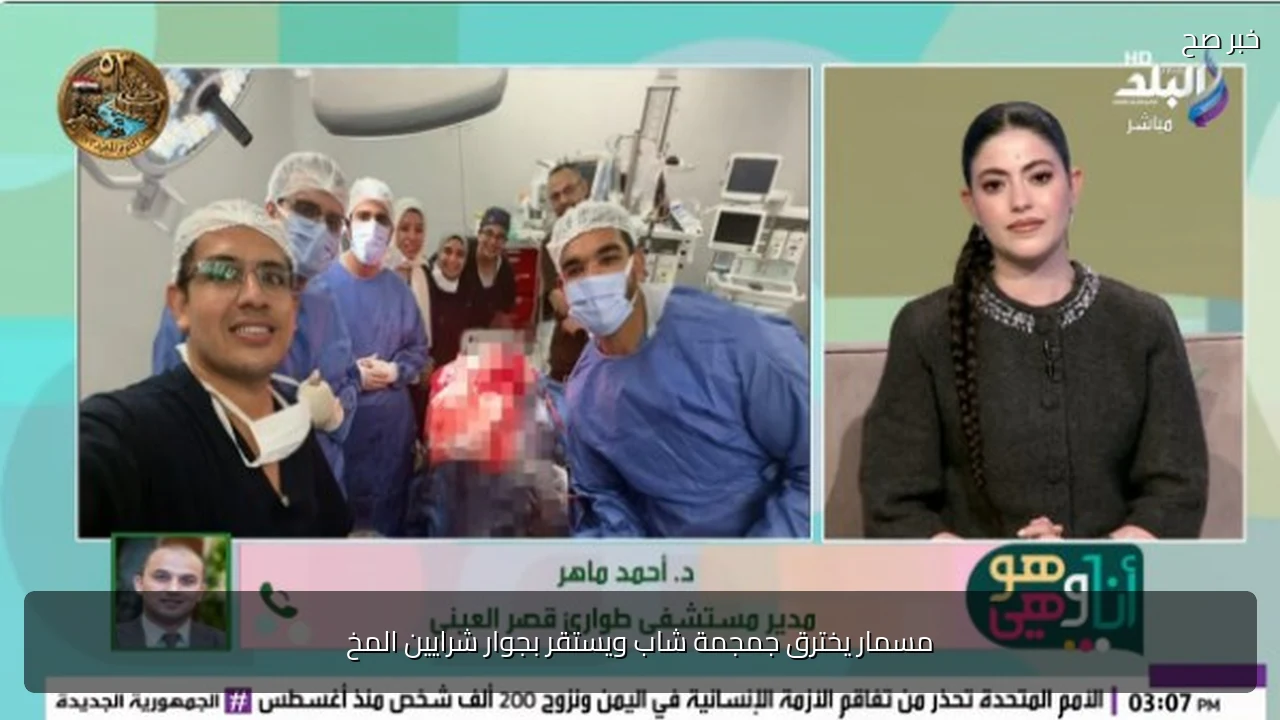 مسمار يخترق جمجمة شاب ويستقر بجوار شرايين المخ