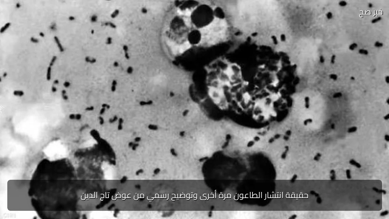 حقيقة انتشار الطاعون مرة أخرى وتوضيح رسمي من عوض تاج الدين