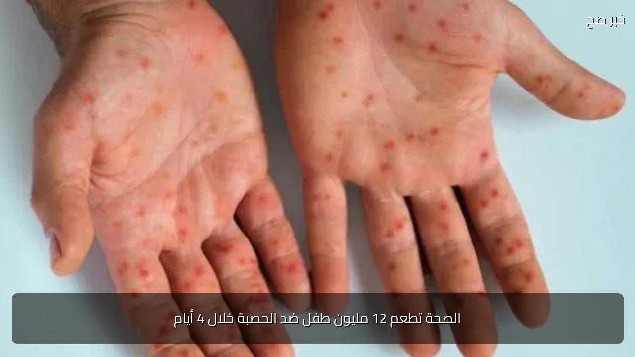 الصحة تطعم 12 مليون طفل ضد الحصبة خلال 4 أيام