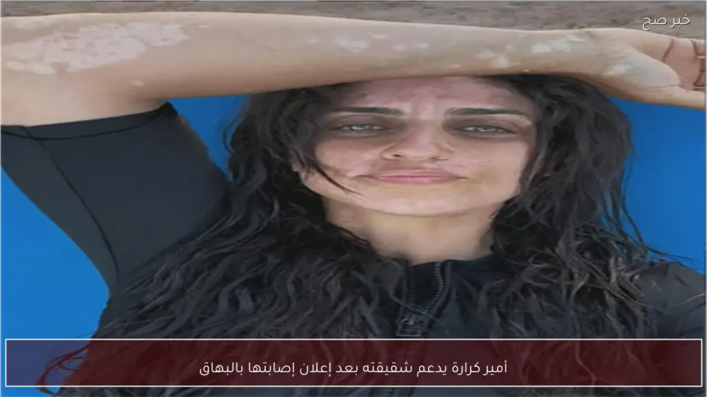 أمير كرارة يدعم شقيقته بعد إعلان إصابتها بالبهاق