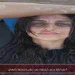 أمير كرارة يدعم شقيقته بعد إعلان إصابتها بالبهاق