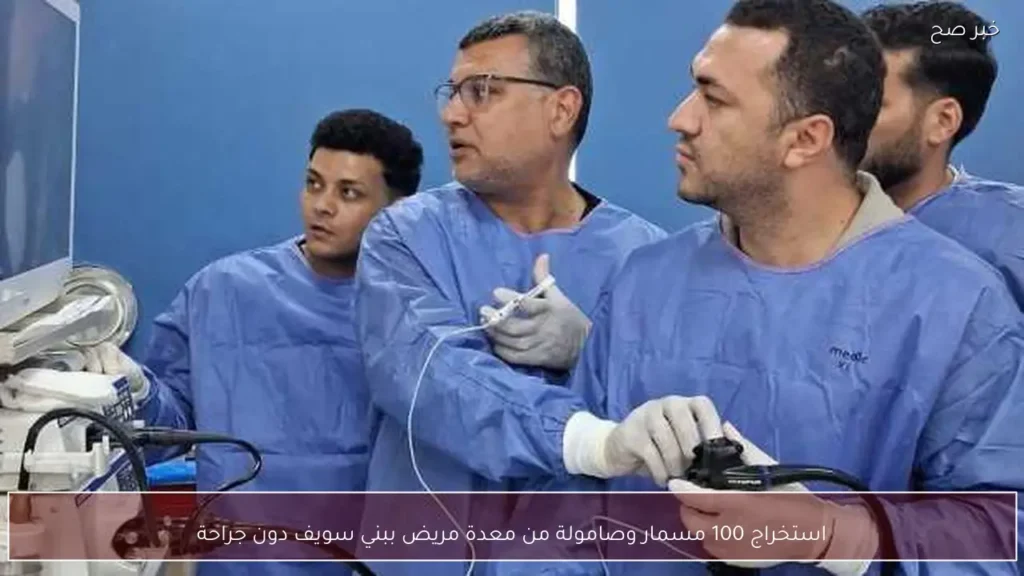 استخراج 100 مسمار وصامولة من معدة مريض ببني سويف دون جراحة