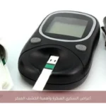 أعراض السكري المبكرة وأهمية الكشف المبكر