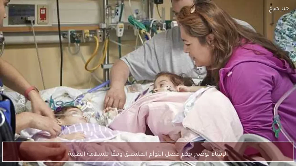 الإفتاء توضح حكم فصل التوأم الملتصق وفقًا للسلامة الطبية