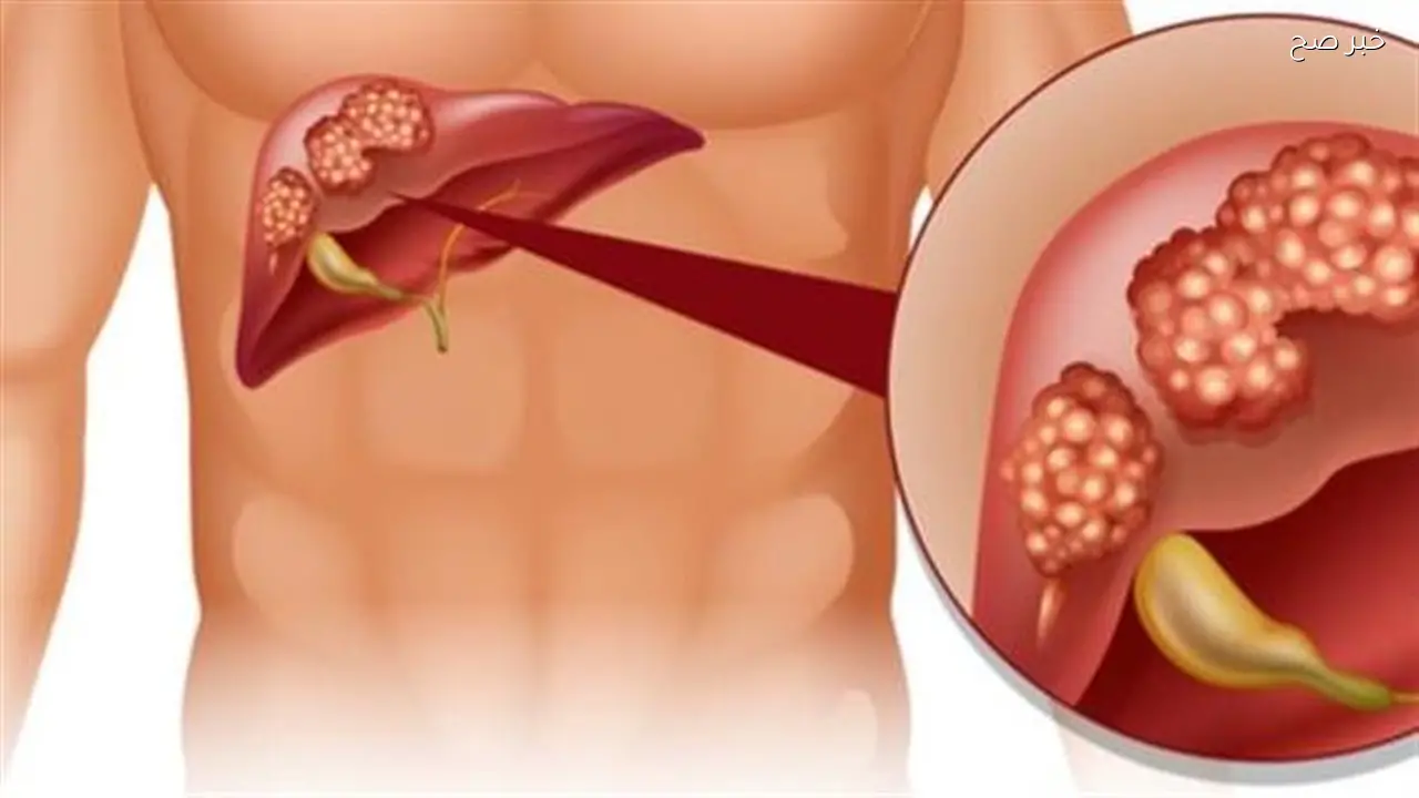 «الصحة» تعلن نجاح زراعة الكبد عن بُعد باستخدام التكنولوجيا الحديثة