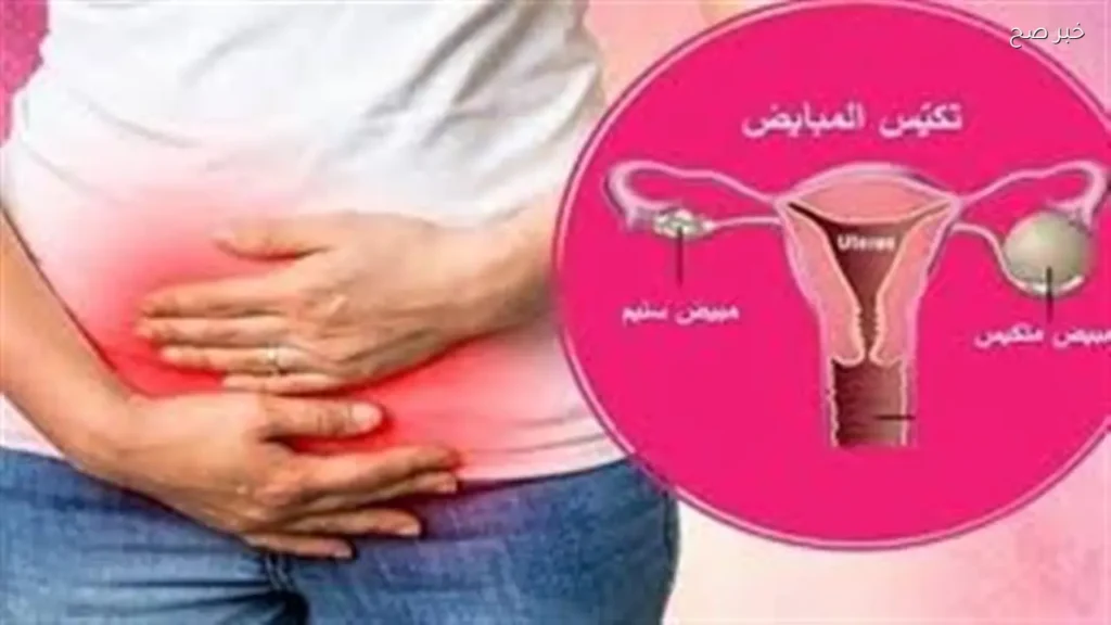 وزارة الصحة: تكيس المبايض يؤثر على فرص الحمل